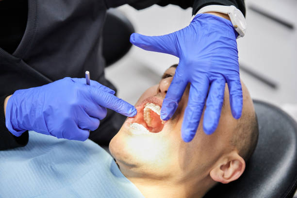 Best Emergency Wisdom Tooth Extraction in Ada, OK