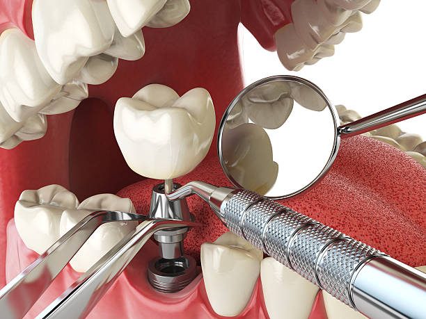 Best Emergency Root Canal Therapy in Ada, OK